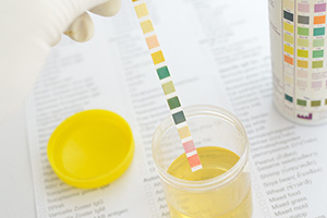 Lab Testing Benefits & Services | Diverse Health Services, PLLC - urine